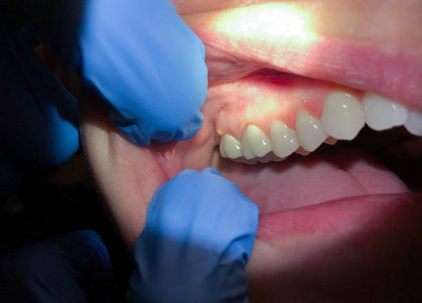 Best Emergency Treatment for Toothache in Robbins, NC