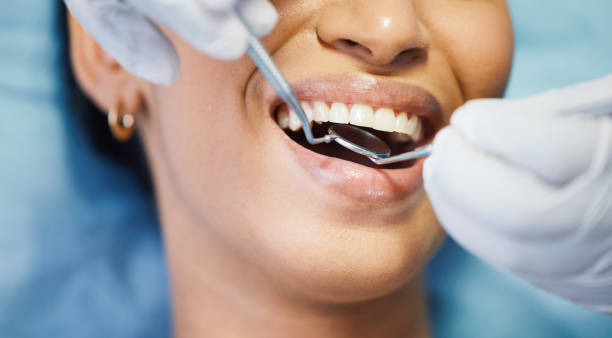 Best Emergency Broken Tooth Repair in Robbins, NC