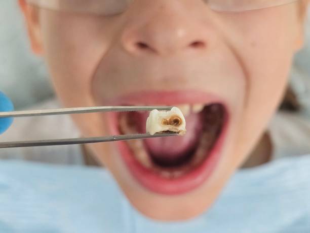 Best Pediatric Emergency Dentist in Robbins, NC