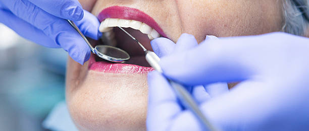 Best Emergency Tooth Extraction in Robbins, NC